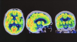 Positron Emission Tomography with monolithic crystals