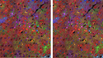 BiaPy, an accessible AI tool for analysing biomedical images