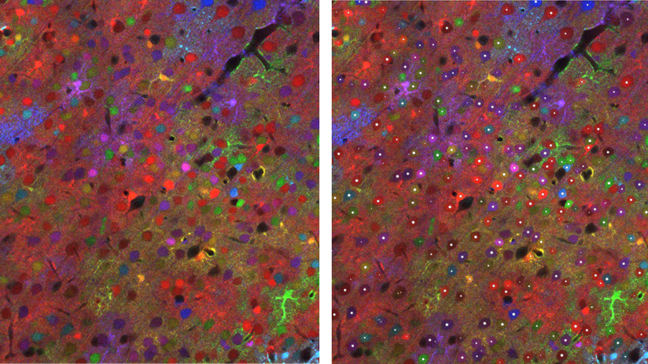 BiaPy, an accessible AI tool for analysing biomedical images BiaPy, an accessible AI tool for analysing biomedical images