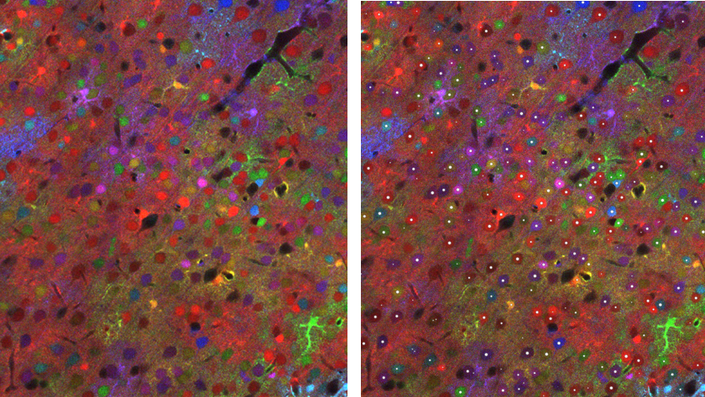 BiaPy, an accessible AI tool for analysing biomedical images