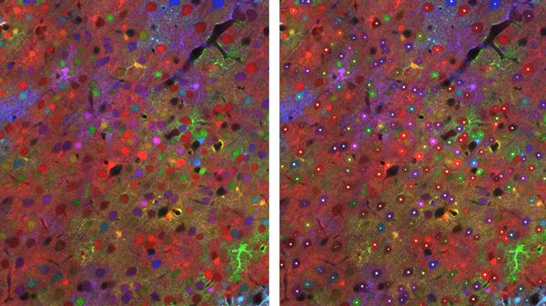 BiaPy, an accessible AI tool for analysing biomedical images