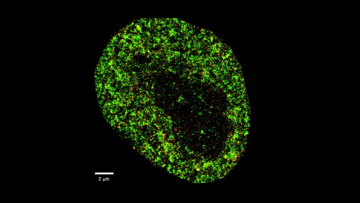 La IA detecta el cáncer y las infecciones virales con precisión nanométrica